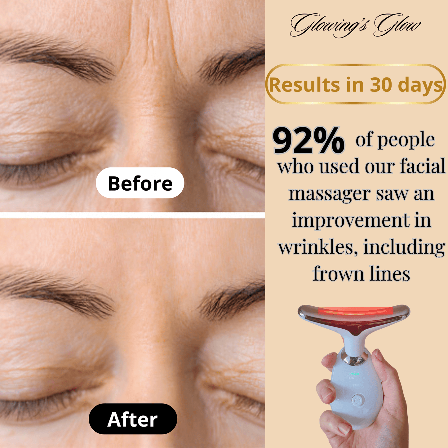 Before & After – 92% of users notice a reduction in wrinkles, including the frown line, as well as firmer and lifted skin after a few weeks of use.