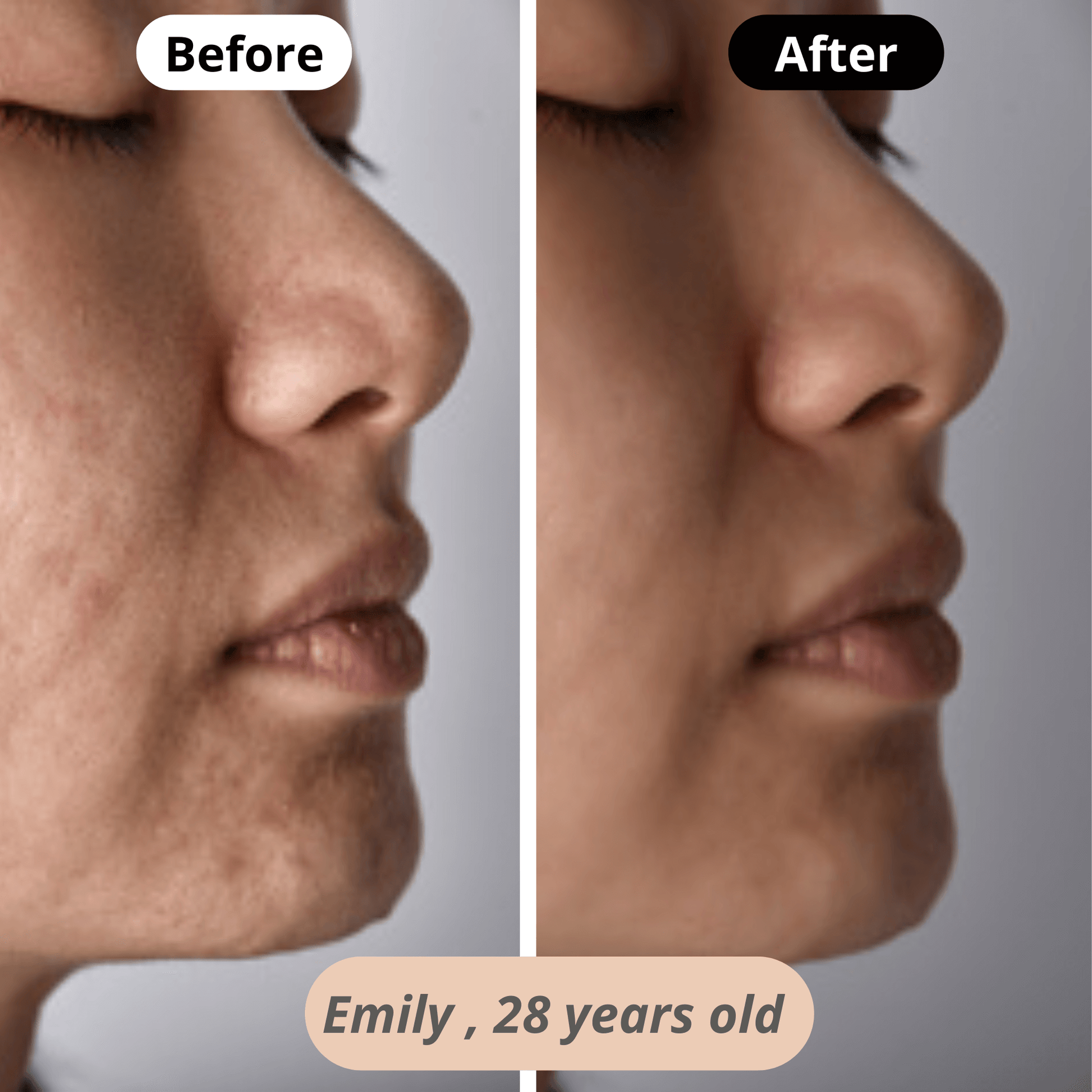 Restored natural glow – Emily (28) enjoys softer, brighter, and more even skin after regular use of our skincare device.