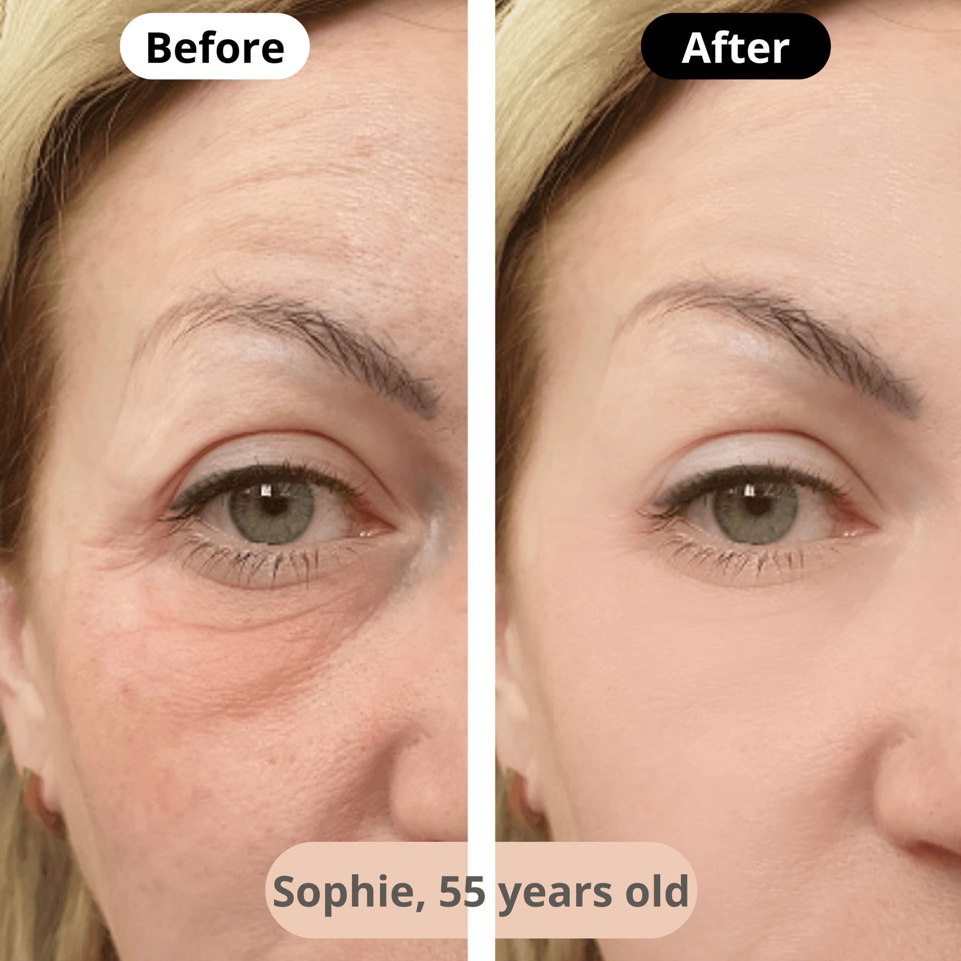 Visible wrinkle reduction – After a few weeks of using the facial massager, Sophie (58) enjoys smoother skin and a rejuvenated look.